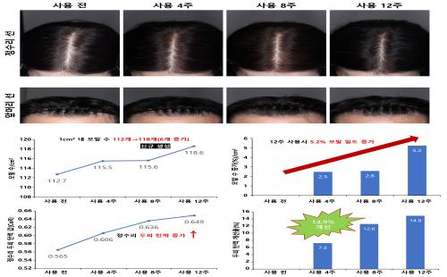 인체적용시험으로 확인된 보리밥나무의 ‘탈모예방 및 개선 효과’